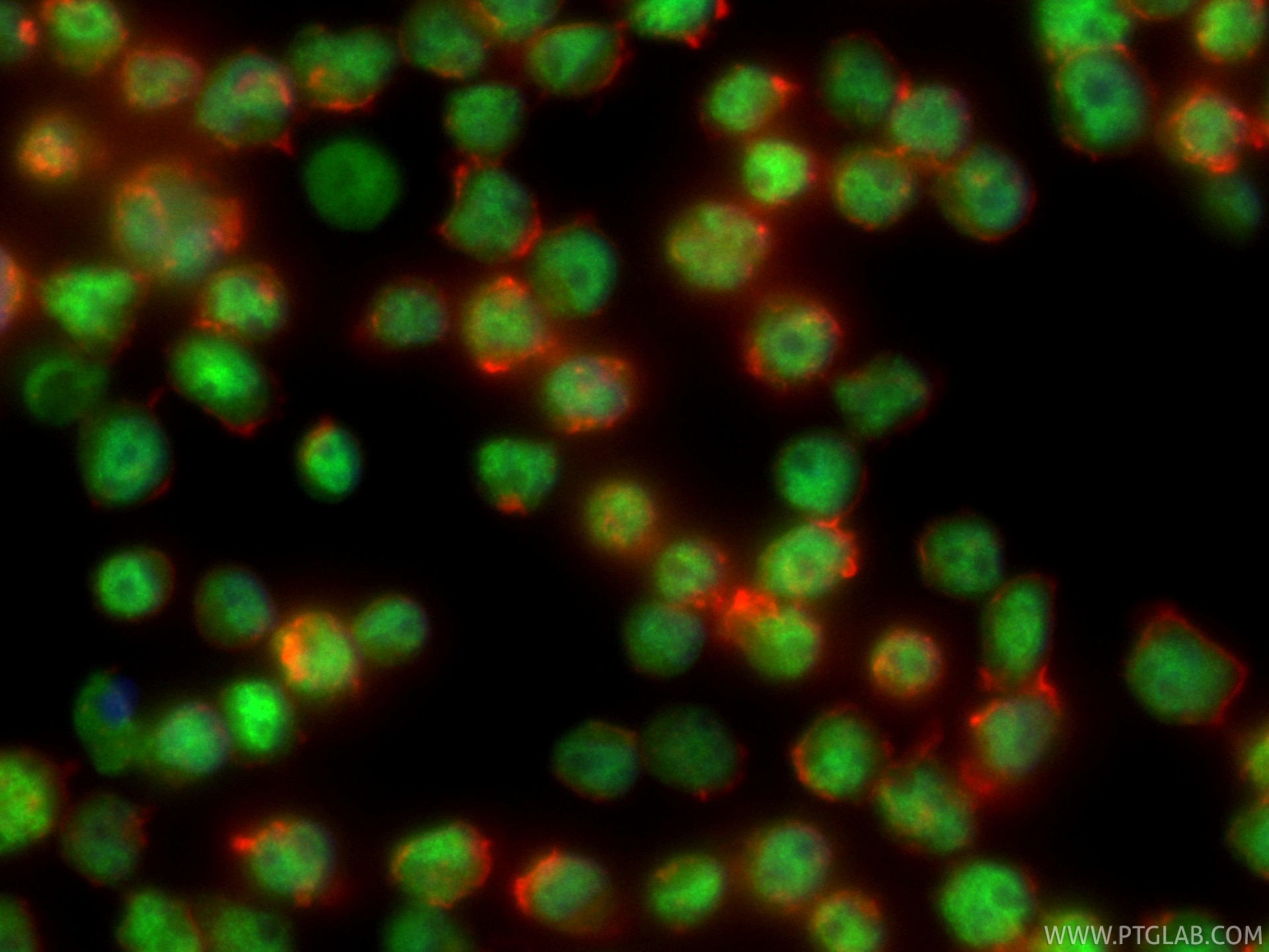 Immunofluorescence (IF) / fluorescent staining of Jurkat cells using CoraLite® Plus 488-conjugated BCL11B Recombinant m (CL488-85363)
