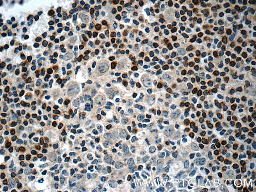 human BCL2 Polyclonal antibody