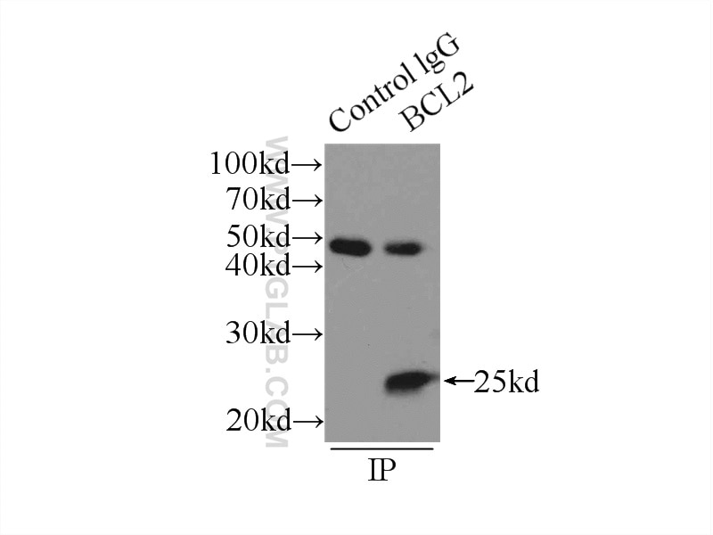 Immunoprecipitation (IP) experiment of MCF-7 cells using human BCL2 Polyclonal antibody (12789-1-AP)