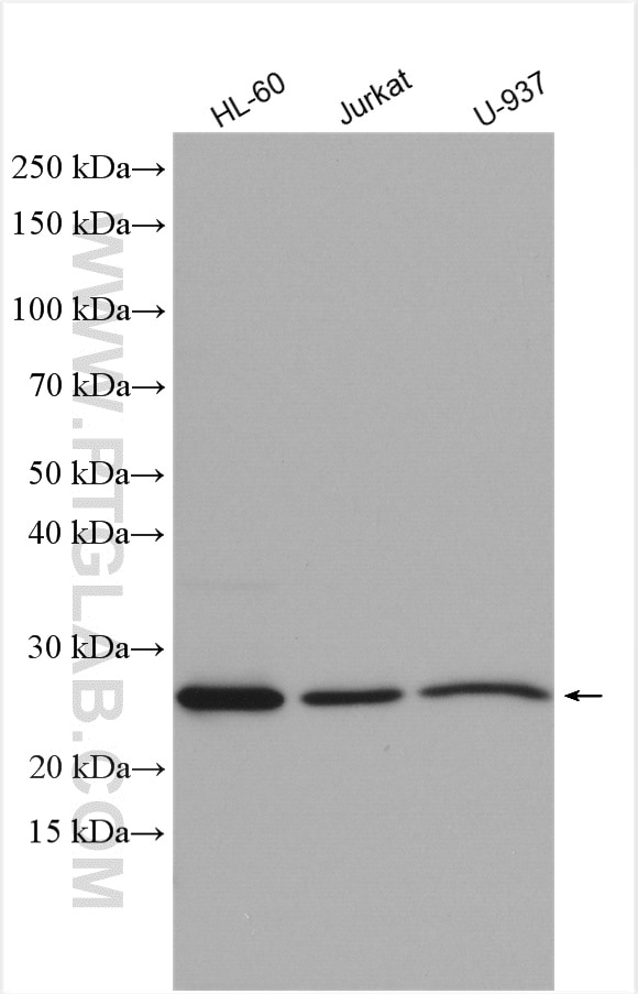 Western Blot (WB) analysis of various lysates using human BCL2 Polyclonal antibody (12789-1-AP)