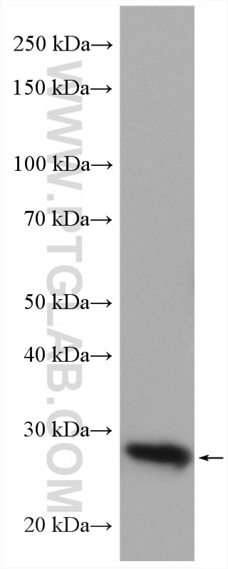 Western Blot (WB) analysis of U-251 cells using human BCL2 Polyclonal antibody (12789-1-AP)