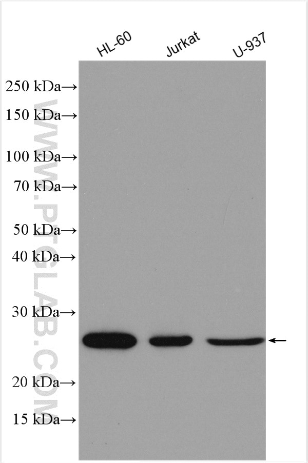 Western Blot (WB) analysis of various lysates using human BCL2 Polyclonal antibody (12789-1-AP)