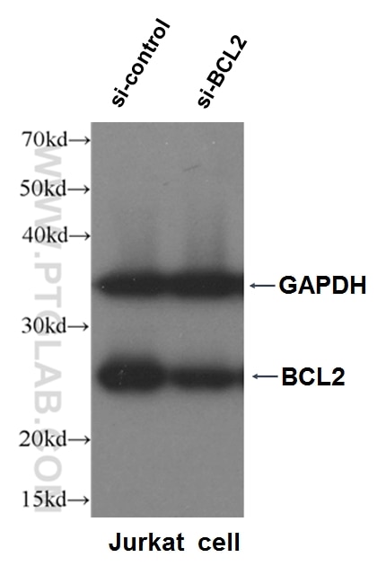 Western Blot (WB) analysis of Jurkat cells using human BCL2 Polyclonal antibody (12789-1-AP)