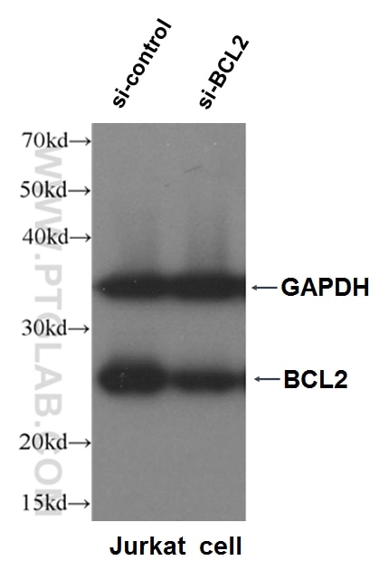 WB analysis of Jurkat cells using 12789-1-AP