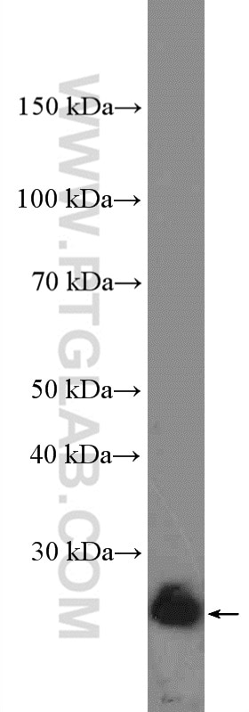 human BCL2 Polyclonal antibody