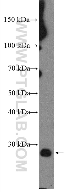 Western Blot (WB) analysis of HEK-293 cells using human BCL2 Polyclonal antibody (12789-1-AP)