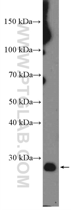 WB analysis of HEK-293 using 12789-1-AP