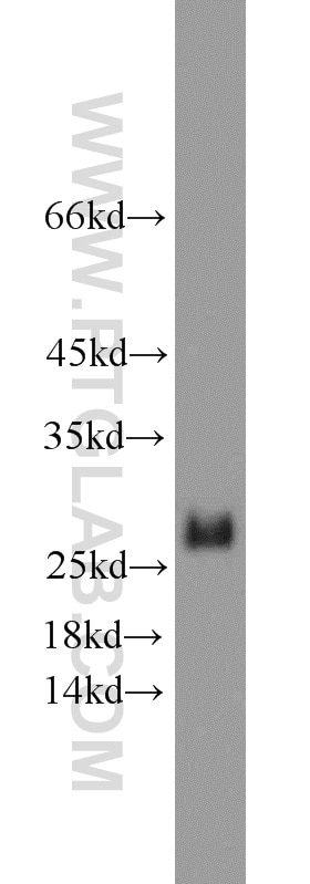 Western Blot (WB) analysis of HepG2 cells using human BCL2 Polyclonal antibody (12789-1-AP)