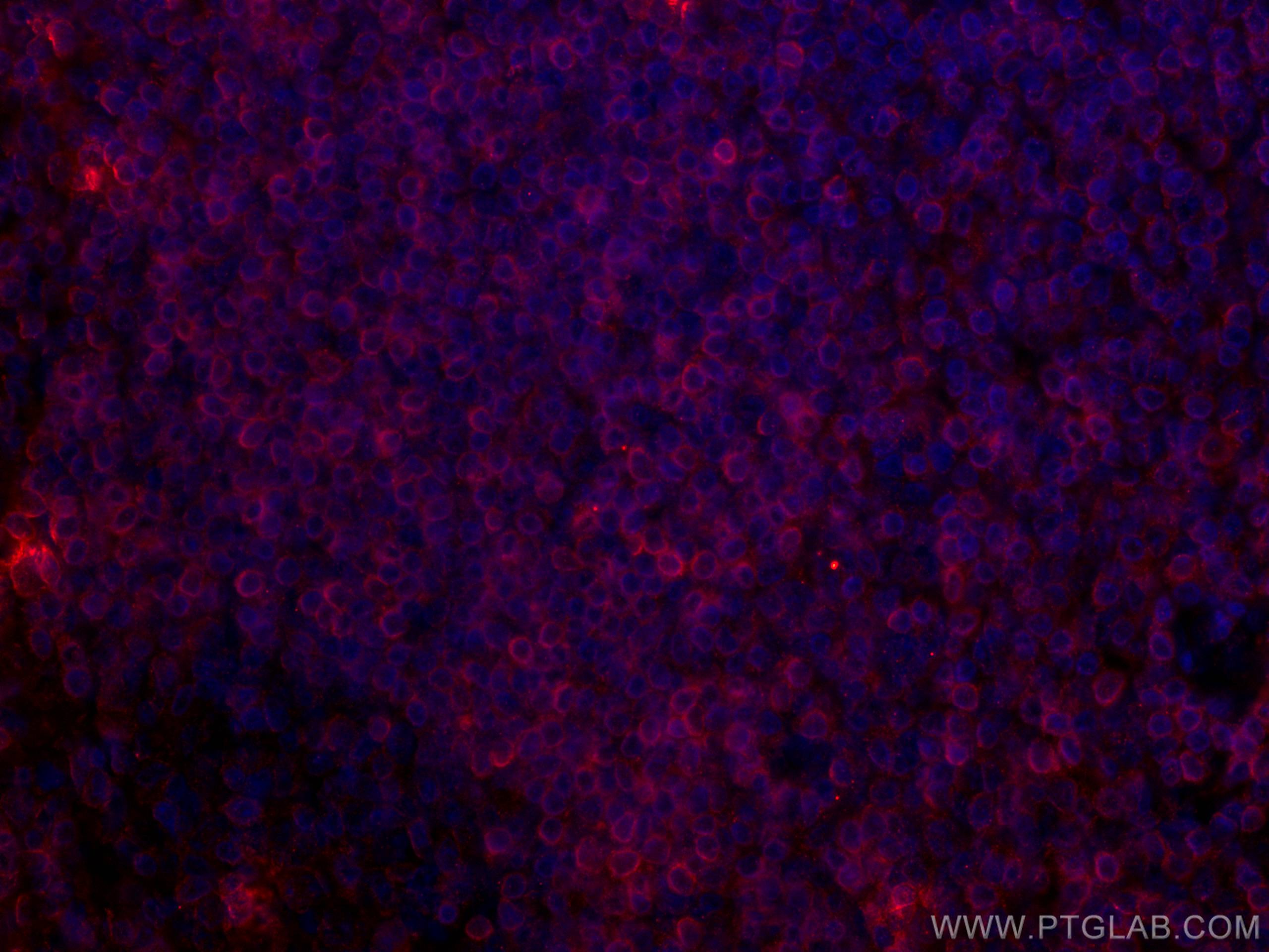 Immunofluorescence (IF) / fluorescent staining of human tonsillitis tissue using BCL2 Monoclonal antibody (60178-1-Ig)