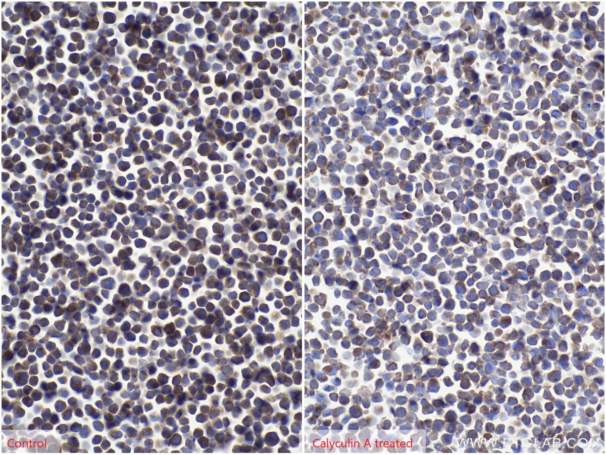 IHC staining of Jurkat using 60178-1-Ig