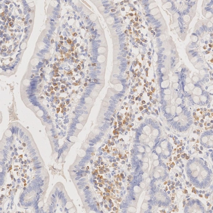 IHC staining of human small intestine using 60178-1-Ig Immunohistochemistry (IHC) staining of human small intestine tissue using BCL2 Monoclonal antibody (60178-1-Ig)