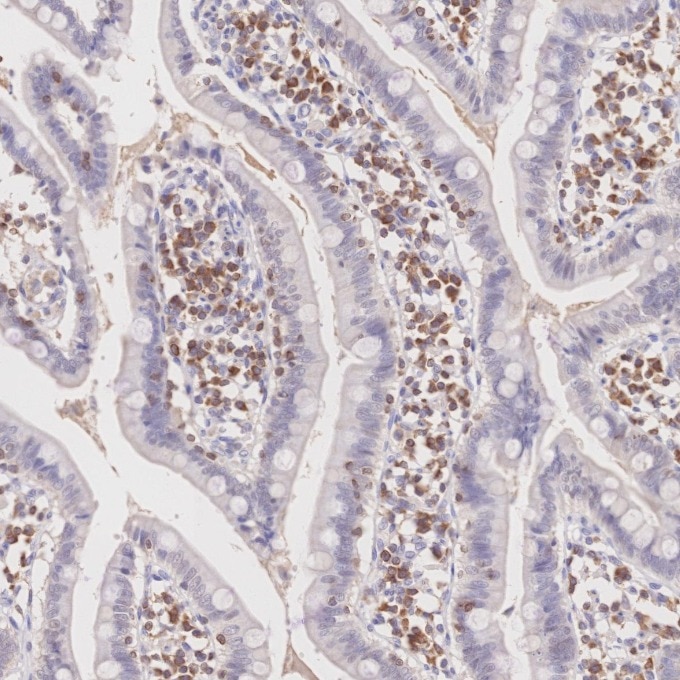 IHC staining of human small intestine using 60178-1-Ig Immunohistochemistry (IHC) staining of human small intestine tissue using BCL2 Monoclonal antibody (60178-1-Ig)