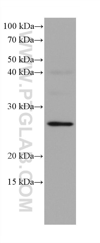 Western Blot (WB) analysis of U2OS cells using BCL2 Monoclonal antibody (60178-1-Ig)