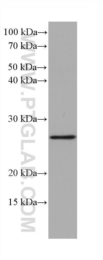 Western Blot (WB) analysis of MCF-7 cells using BCL2 Monoclonal antibody (60178-1-Ig)
