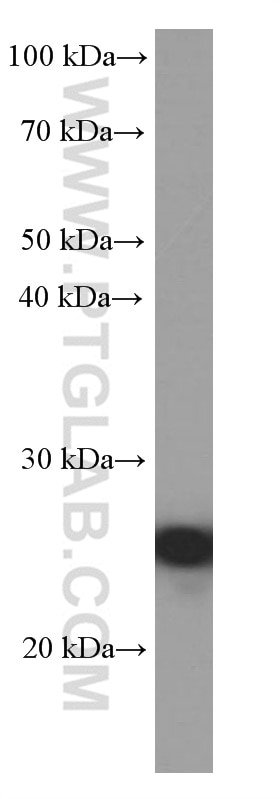 BCL2 Monoclonal antibody