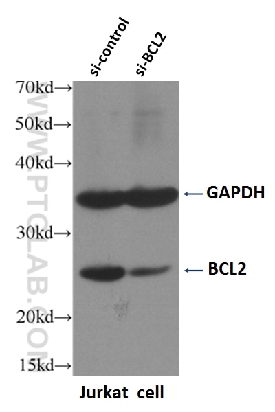 Western Blot (WB) analysis of Jurkat cells using BCL2 Monoclonal antibody (60178-1-Ig)