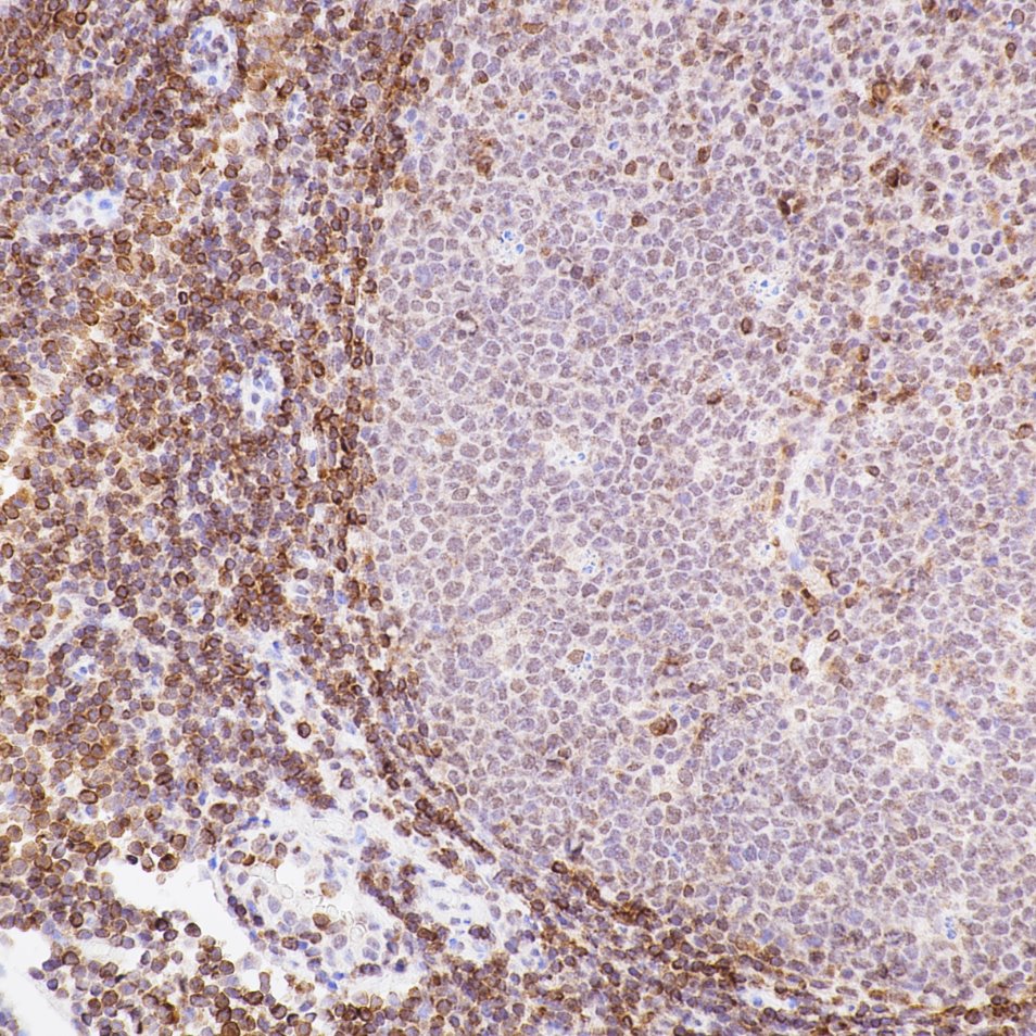 Immunohistochemistry (IHC) staining of Human Tonsil​ using BCL2 Recombinant monoclonal antibody (80313-1-RR)
