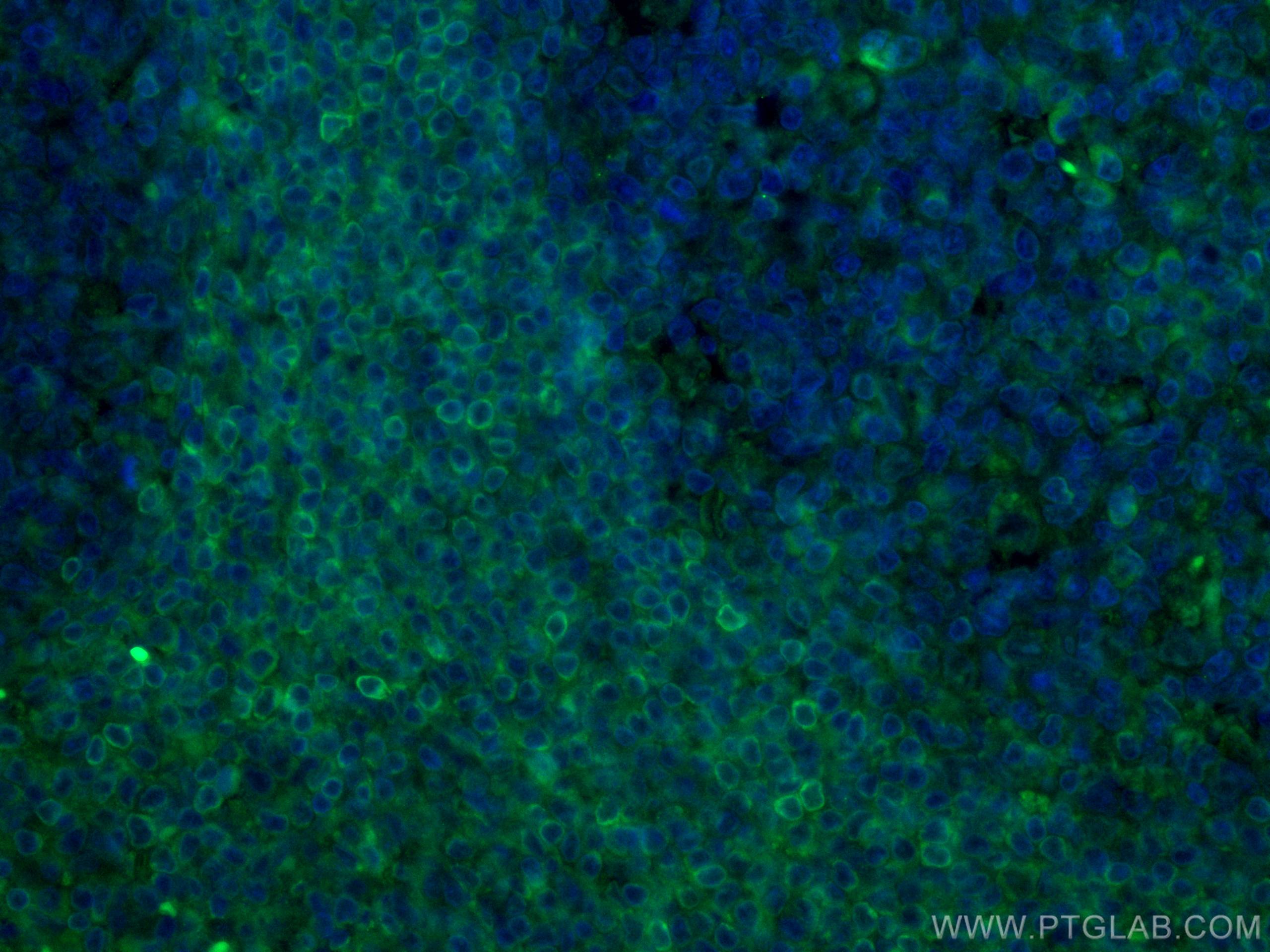 Immunofluorescence (IF) / fluorescent staining of human tonsillitis tissue using CoraLite® Plus 488-conjugated BCL2 Monoclonal anti (CL488-60178)