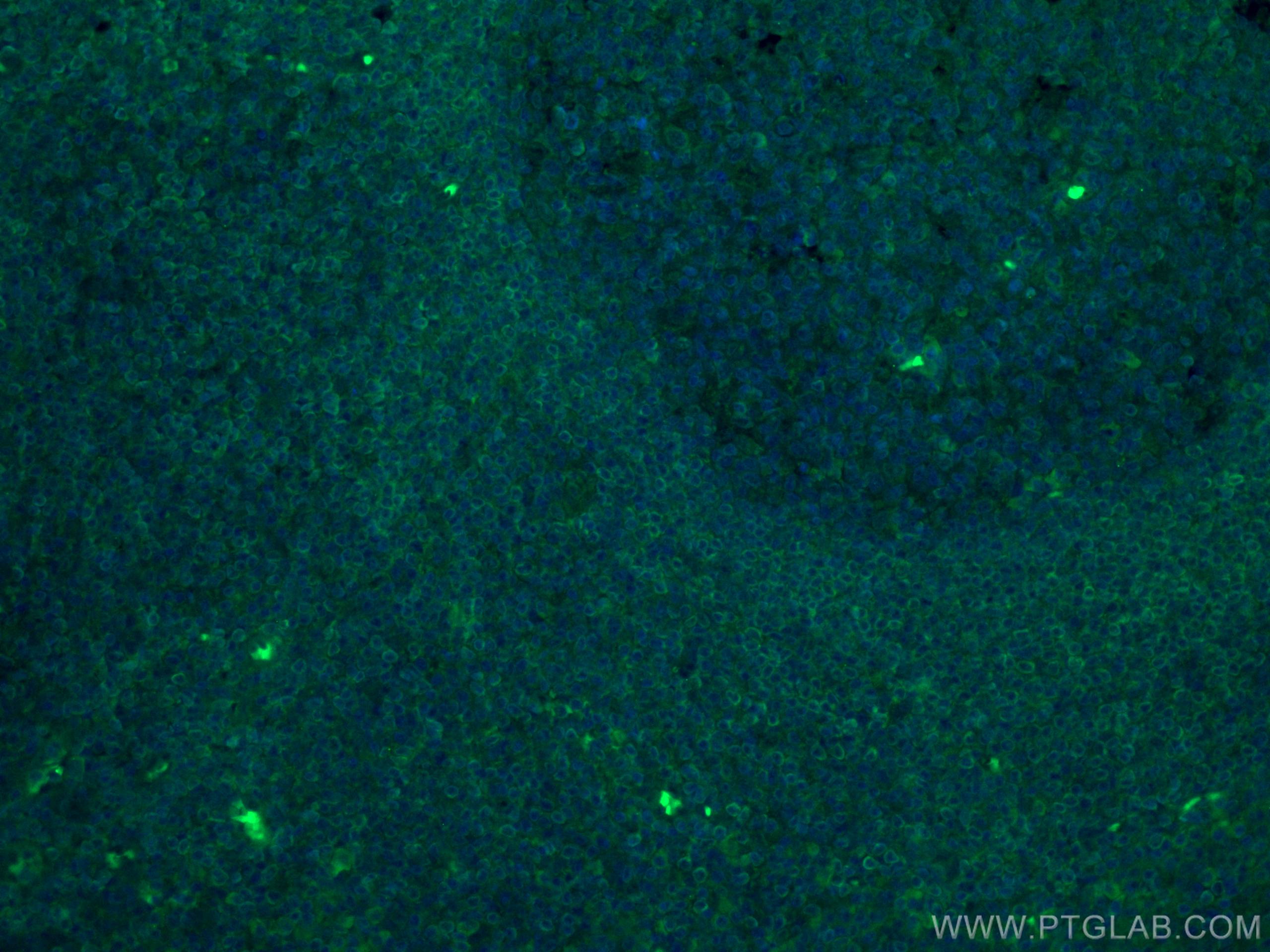 Immunofluorescence (IF) / fluorescent staining of human tonsillitis tissue using CoraLite® Plus 488-conjugated BCL2 Monoclonal anti (CL488-60178)