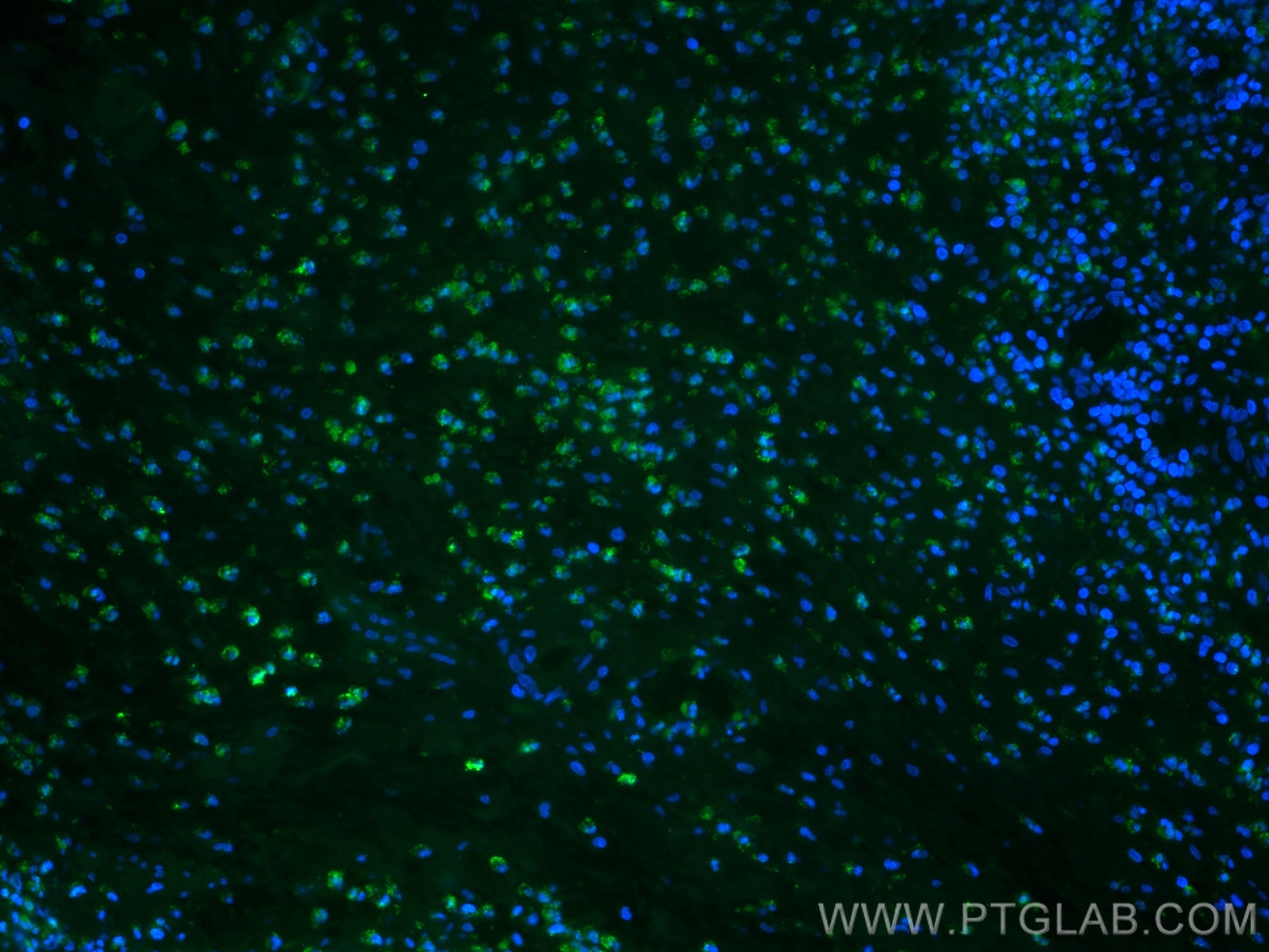 Immunofluorescence (IF) / fluorescent staining of human appendicitis tissue using CoraLite® Plus 488-conjugated BCL2 Monoclonal anti (CL488-60178)