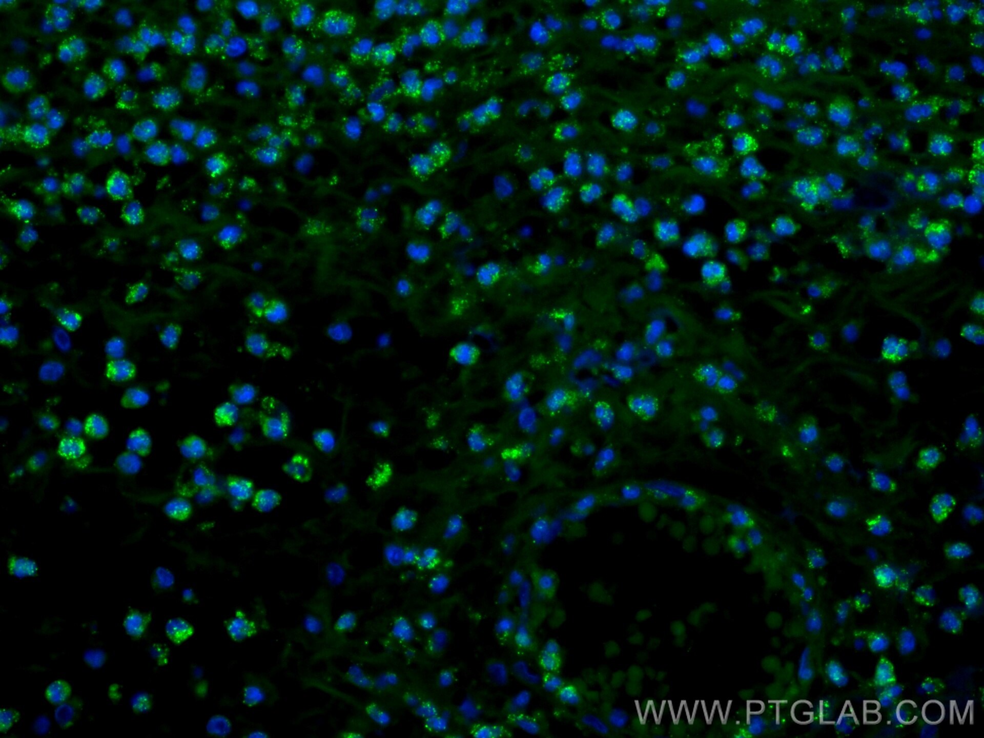 Immunofluorescence (IF) / fluorescent staining of human appendicitis tissue using CoraLite® Plus 488-conjugated BCL2 Monoclonal anti (CL488-60178)