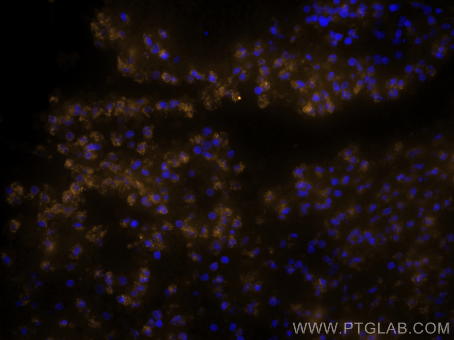Immunofluorescence (IF) / fluorescent staining of human appendicitis tissue using CoraLite®555-conjugated BCL2 Monoclonal antibody (CL555-60178)