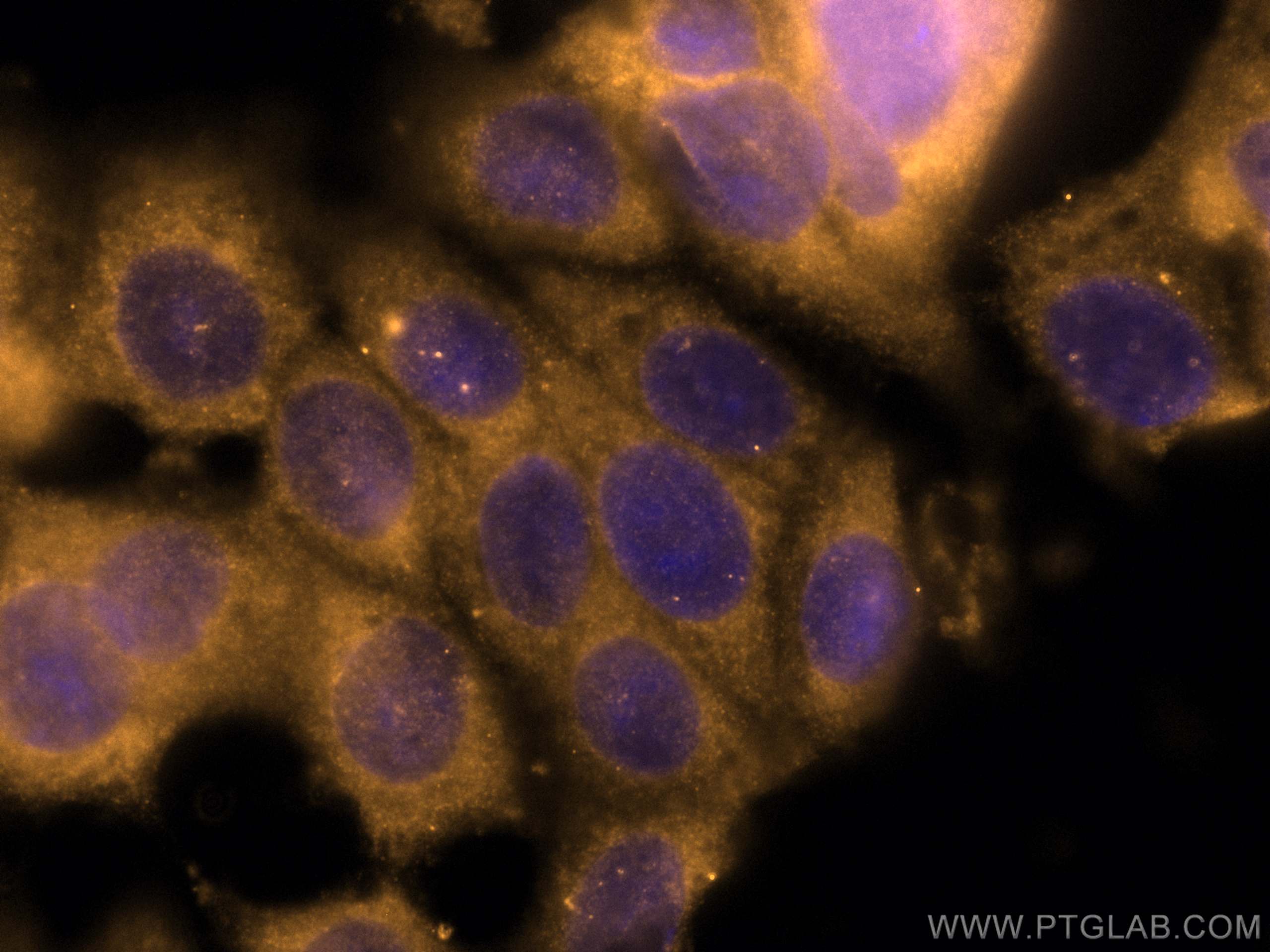 Immunofluorescence (IF) / fluorescent staining of MCF-7 cells using CoraLite®555-conjugated BCL2 Monoclonal antibody (CL555-60178)