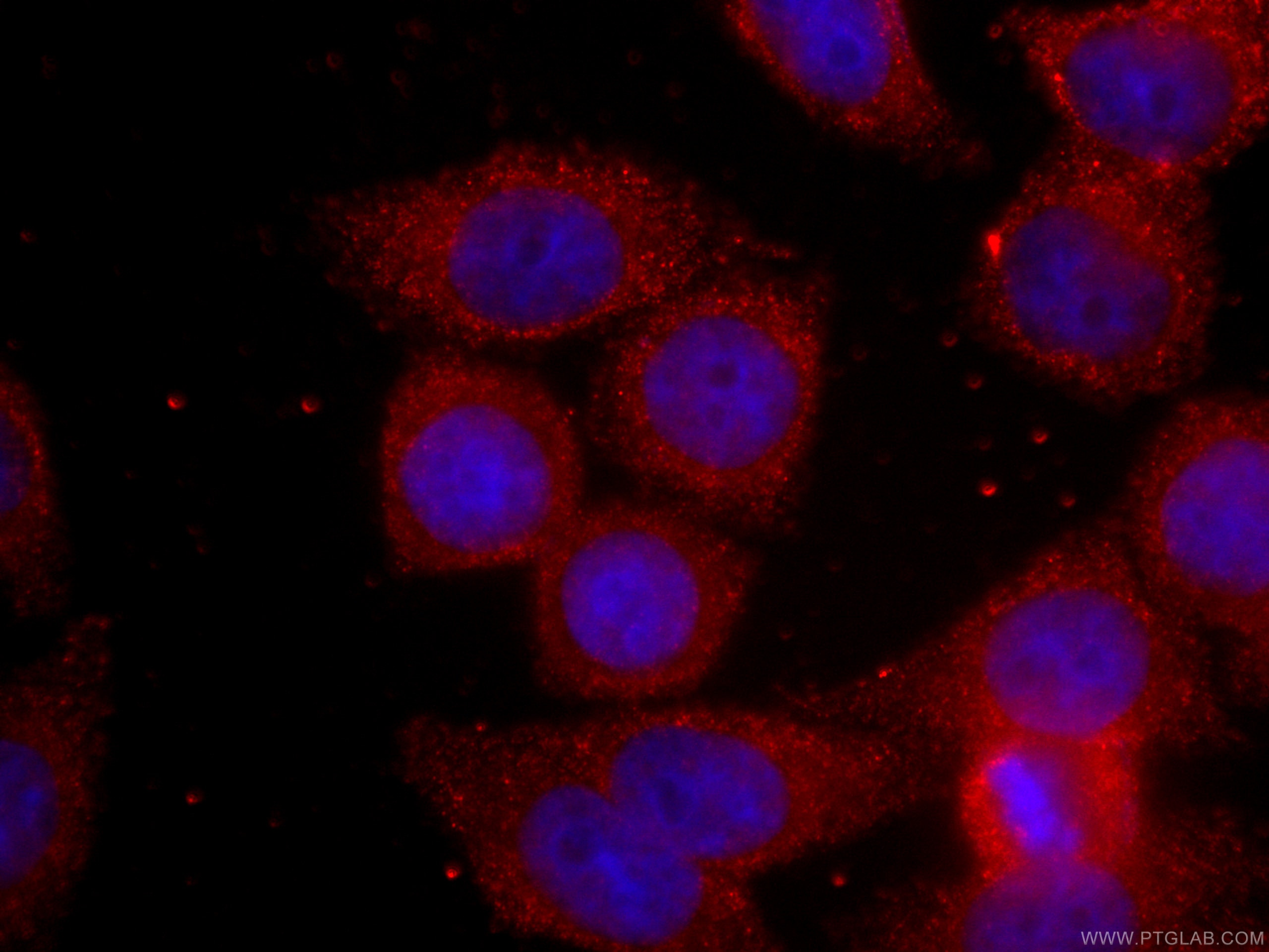 IF Staining of HeLa using CL594-60178