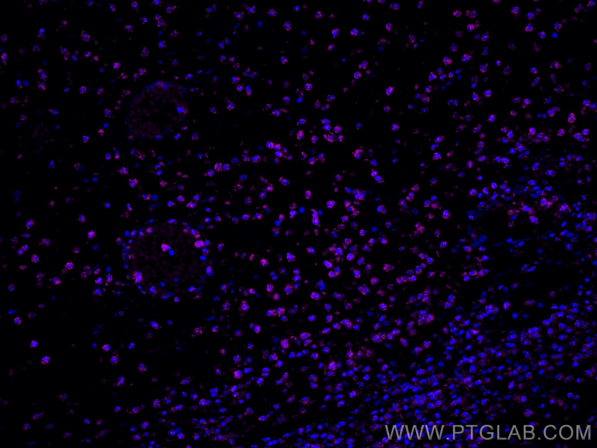 IF Staining of human appendicitis using CL647-80313