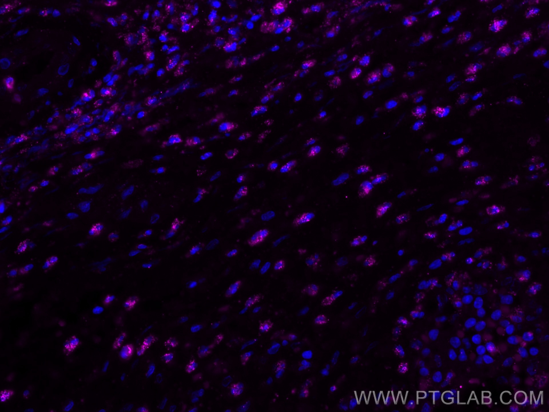 Immunofluorescence (IF) / fluorescent staining of human appendicitis tissue using CoraLite® Plus 647-conjugated BCL2 Recombinant ant (CL647-80313)