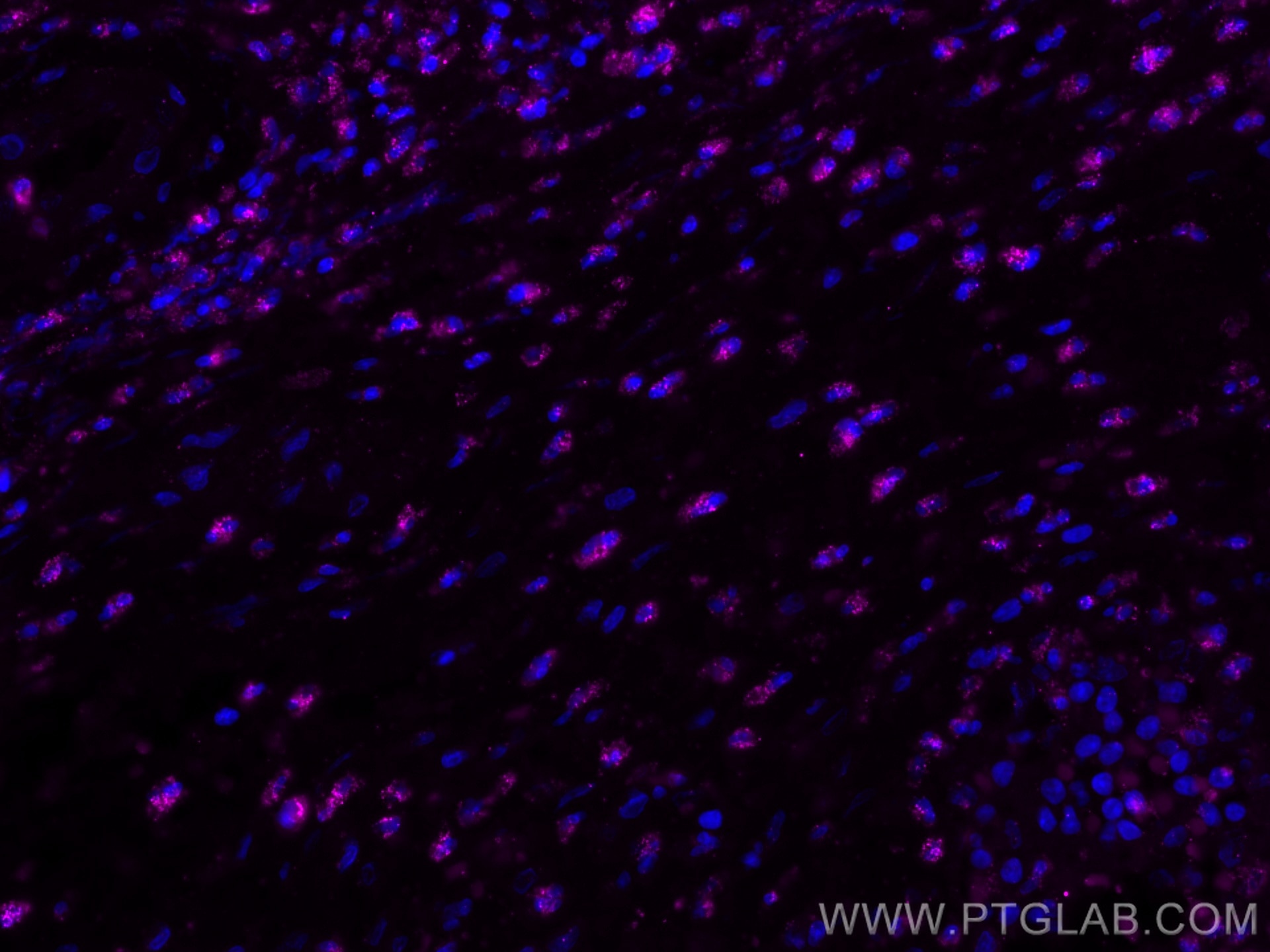 IF Staining of human appendicitis using CL647-80313