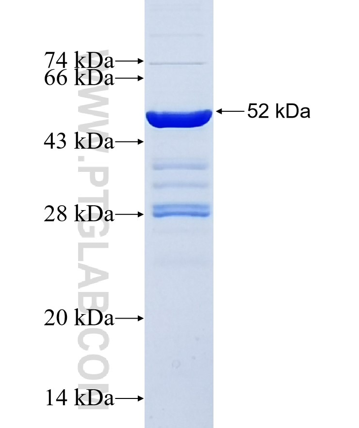 BCL2 fusion protein Ag3508 SDS-PAGE