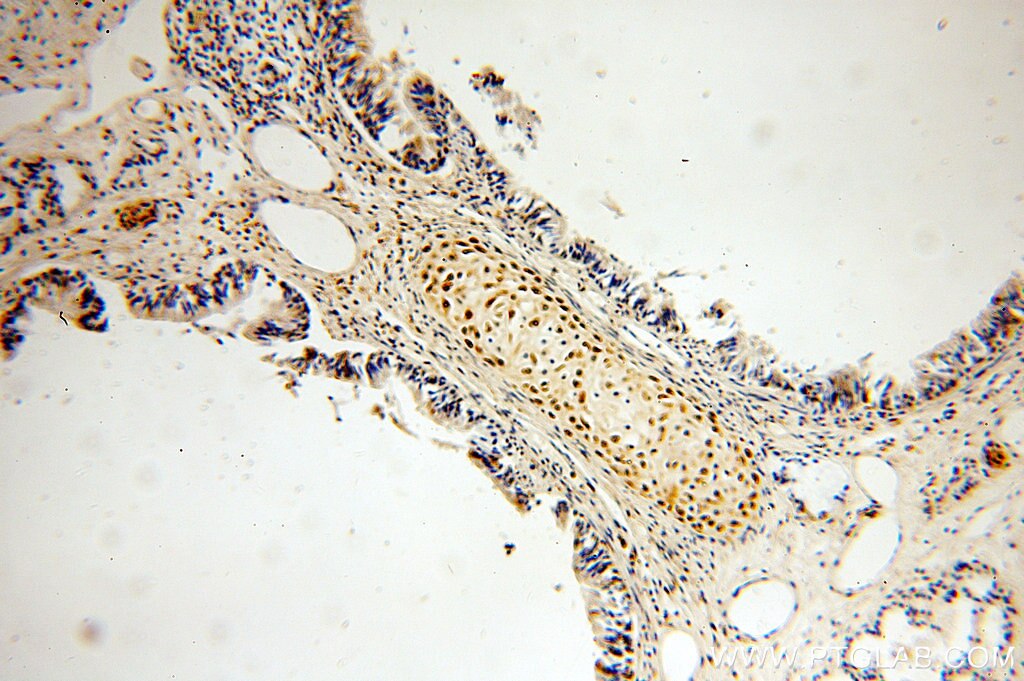 Immunohistochemistry (IHC) staining of human lung tissue using BCL2L10 Polyclonal antibody (18114-1-AP)