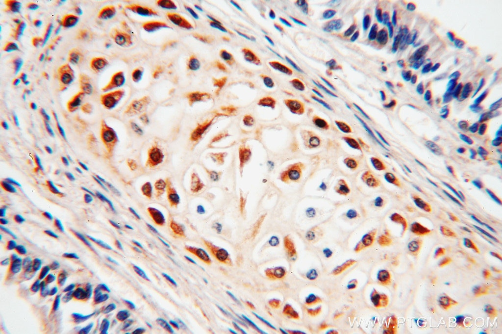 Immunohistochemistry (IHC) staining of human lung tissue using BCL2L10 Polyclonal antibody (18114-1-AP)