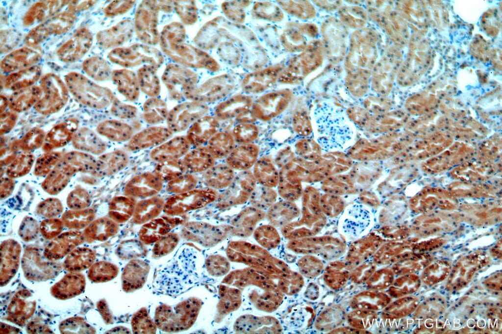 Immunohistochemistry (IHC) staining of human kidney tissue using BCL2L10 Polyclonal antibody (18114-1-AP)