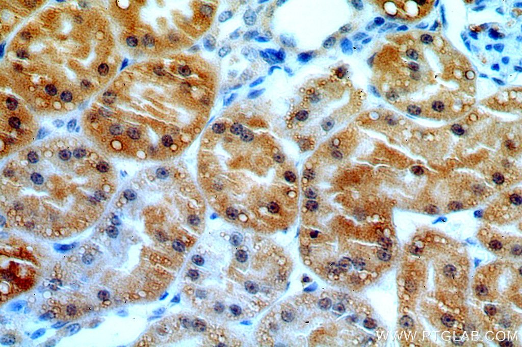 IHC staining of human kidney using 18114-1-AP