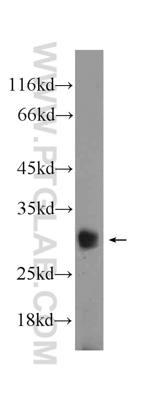 Western Blot (WB) analysis of PC-3 cells using BCL2L12 Polyclonal antibody (21969-1-AP)