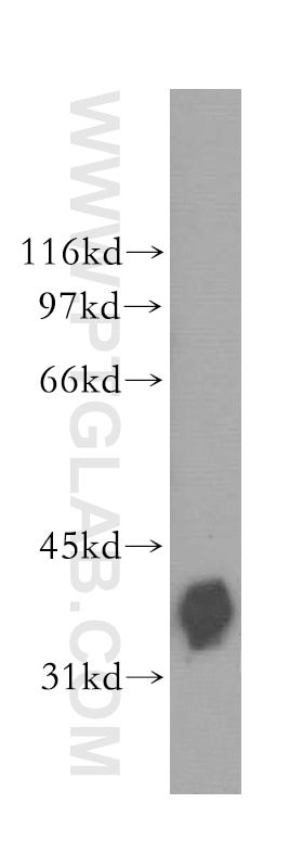 Western Blot (WB) analysis of human lung tissue using BCL2L14 Polyclonal antibody (12846-1-AP)