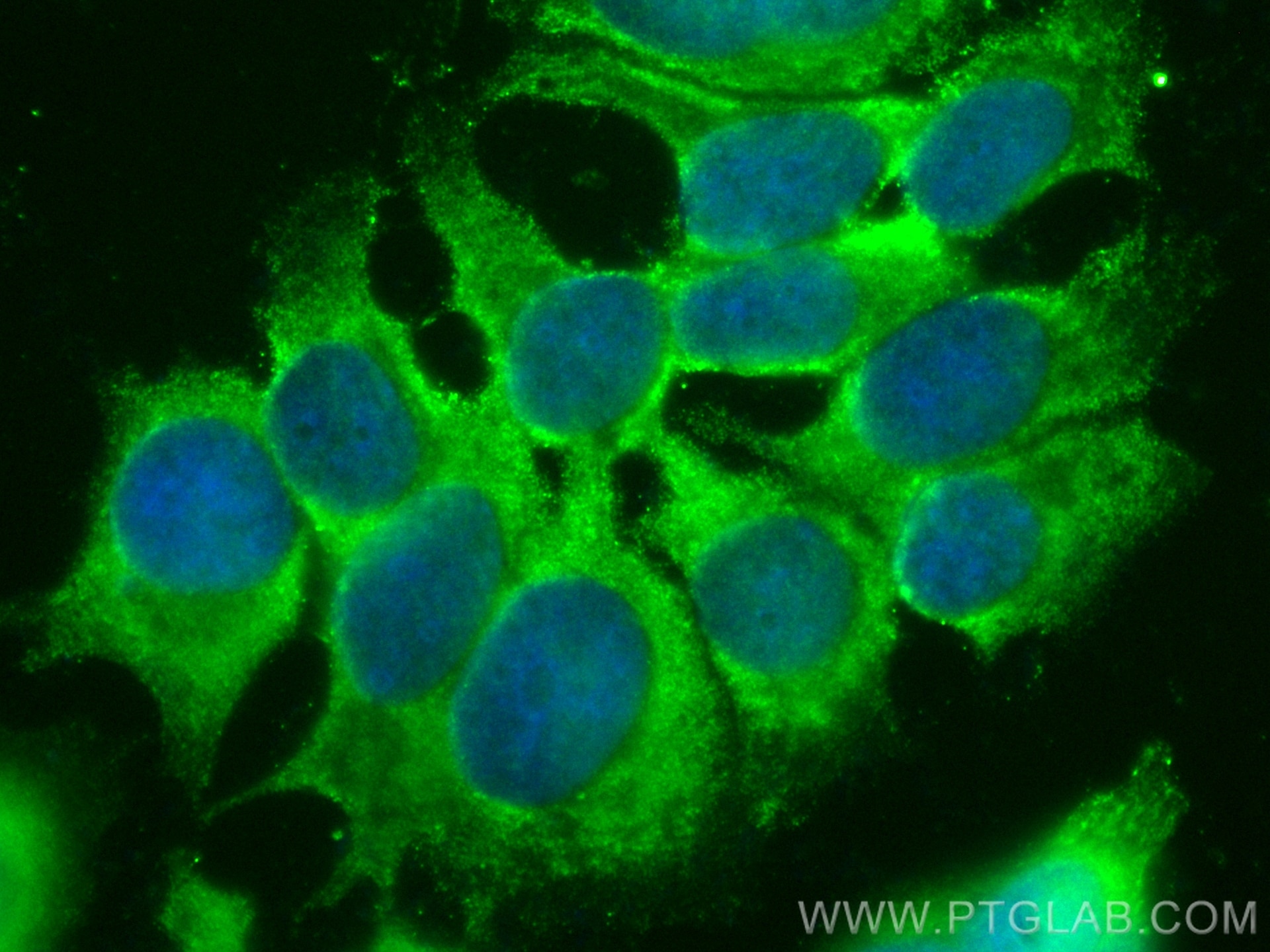 Immunofluorescence (IF) / fluorescent staining of MCF-7 cells using CoraLite® Plus 488-conjugated BCL2L14 Polyclonal a (CL488-12846)