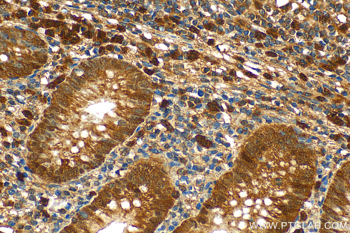Immunohistochemistry (IHC) staining of human appendicitis tissue using BCL2L15 Polyclonal antibody (23975-1-AP)