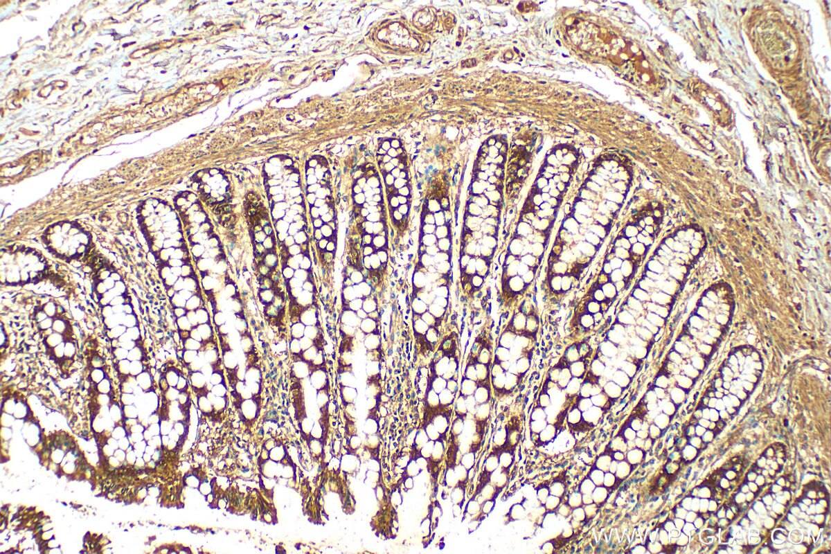 Immunohistochemistry (IHC) staining of human colon tissue using BCL2L15 Polyclonal antibody (23975-1-AP)