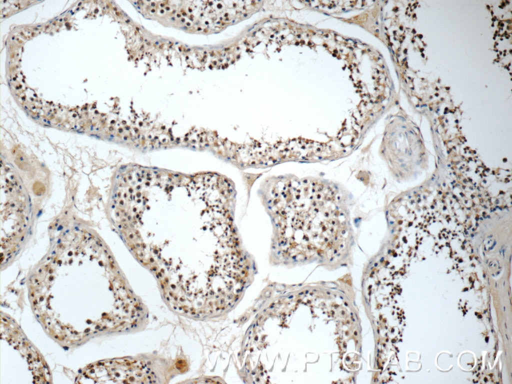 Immunohistochemistry (IHC) staining of human testis tissue using BCL2L2 Polyclonal antibody (25850-1-AP)