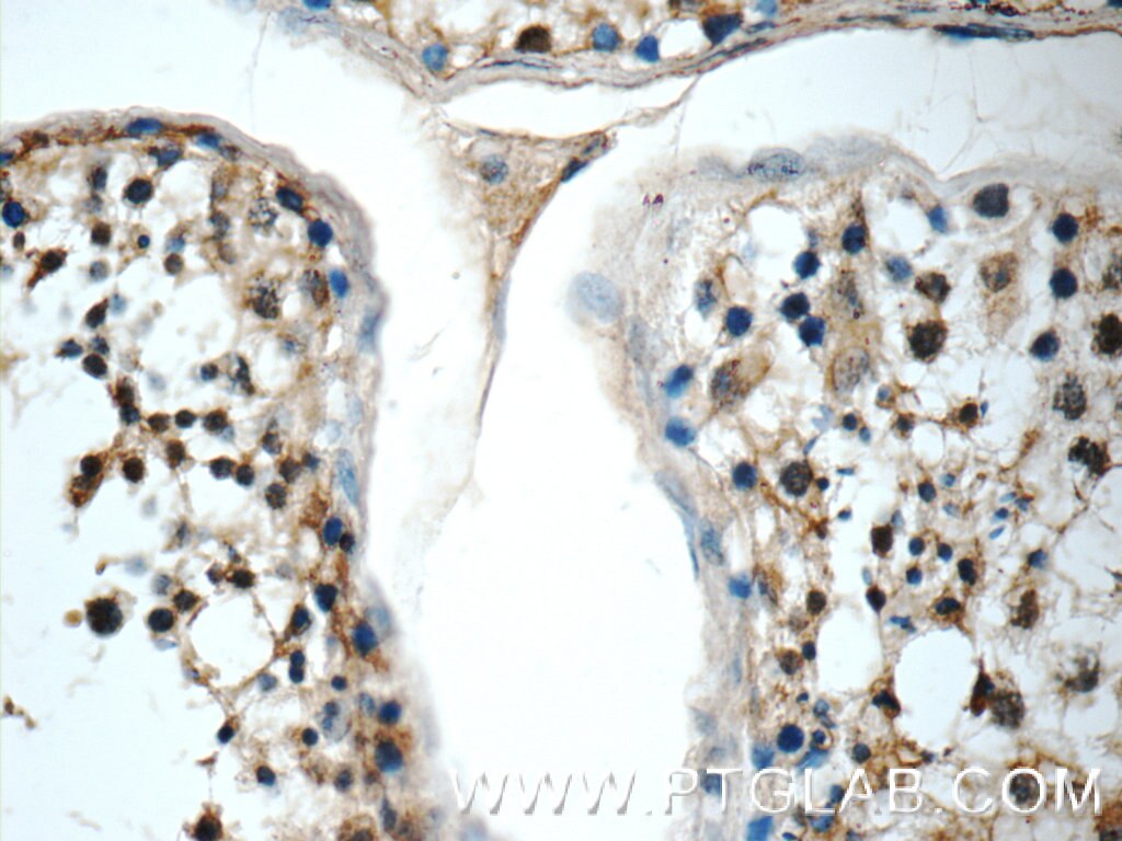 Immunohistochemistry (IHC) staining of human testis tissue using BCL2L2 Polyclonal antibody (25850-1-AP)