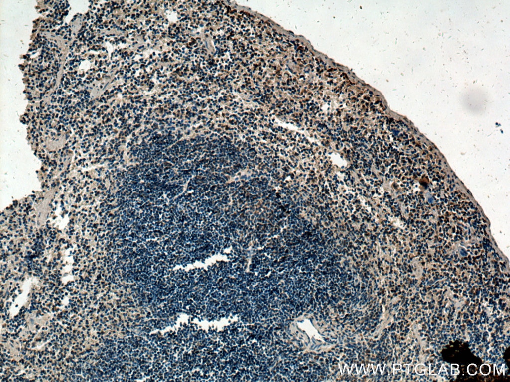 Immunohistochemistry (IHC) staining of mouse spleen tissue using BCL3 Polyclonal antibody (23959-1-AP)