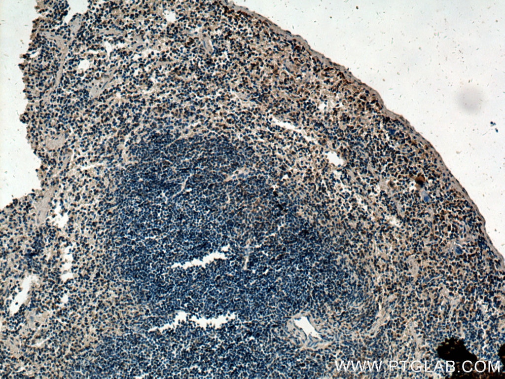 IHC staining of mouse spleen using 23959-1-AP