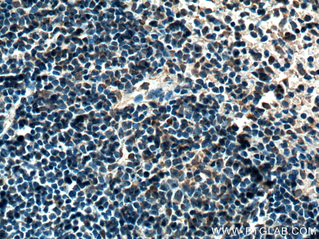 Immunohistochemistry (IHC) staining of mouse spleen tissue using BCL3 Polyclonal antibody (23959-1-AP)