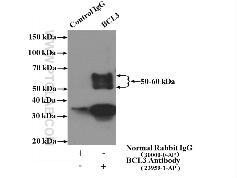 Immunoprecipitation (IP) experiment of HEK-293 cells using BCL3 Polyclonal antibody (23959-1-AP)