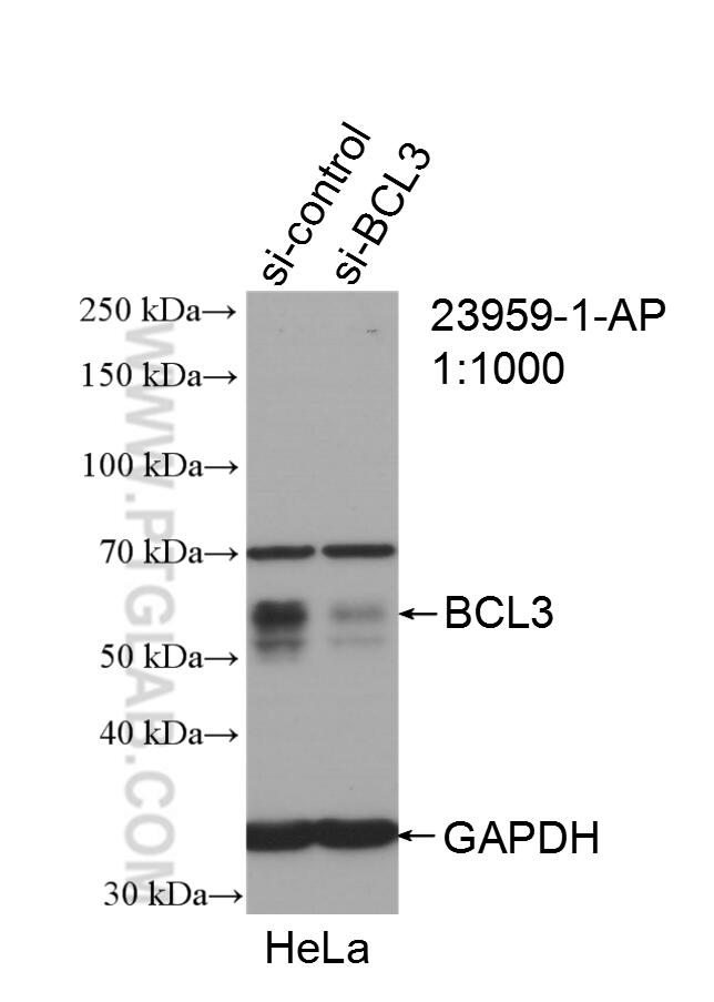 Western Blot (WB) analysis of HeLa cells using BCL3 Polyclonal antibody (23959-1-AP)