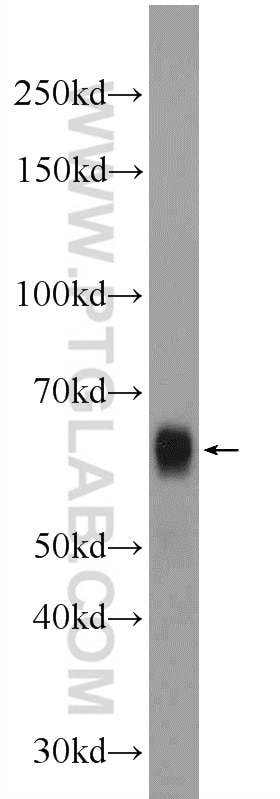 Western Blot (WB) analysis of HEK-293 cells using BCL3 Polyclonal antibody (23959-1-AP)