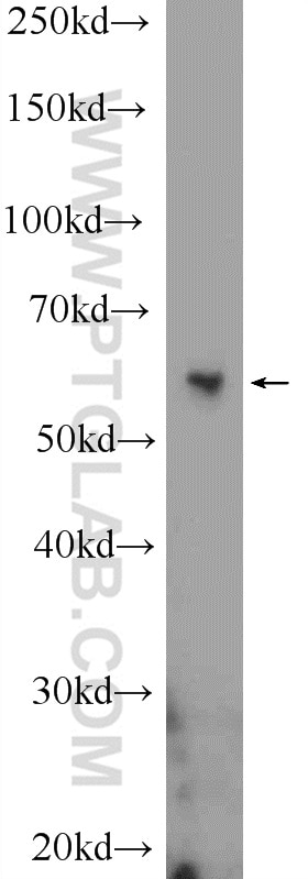 Western Blot (WB) analysis of HEK-293 cells using BCL3 Polyclonal antibody (23959-1-AP)
